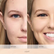 Light (Neutral Undertones)