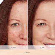 Light (Neutral Undertones)